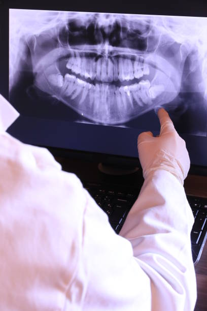 Best Knocked-Out Tooth Emergency  in Lyndhurst, OH