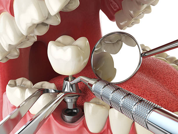Best Urgent Tooth Repair  in Lyndhurst, OH